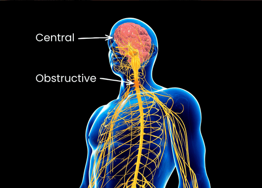 Central vs Obstructive Sleep Apnea - CPAP Direct