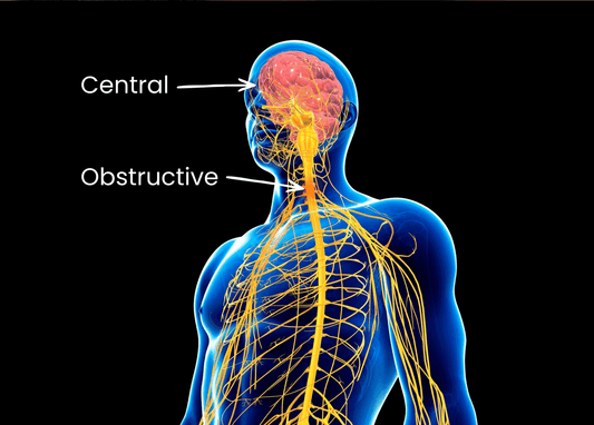 Central vs Obstructive Sleep Apnea - CPAP Direct