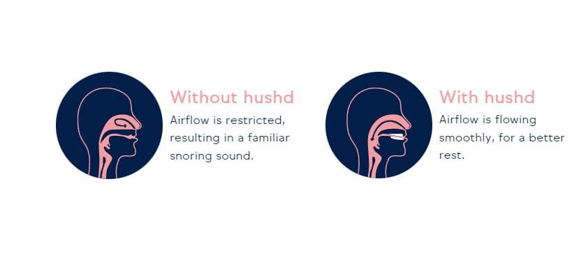 Hushd Anti-Snore Mouthpiece Alternative Therapy Good Sleep Co 